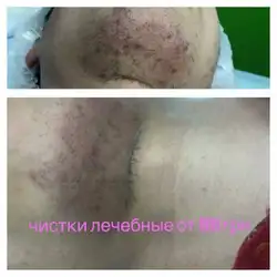 Лета Денисова Косметолог