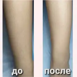Аліна Гладченко майстер депіляції — Одесса