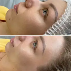 Beauty Line -лазерна епіляція та косметологія