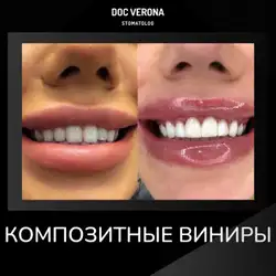 Вероніка Григоріадис