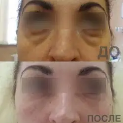 Аліса Гончар