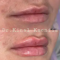 Ксенія Киналь