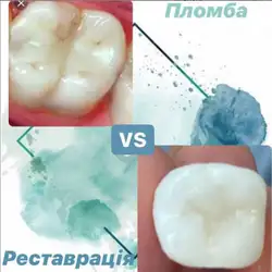 Катерина Власюк