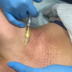 Aesthetics Hall Clinic