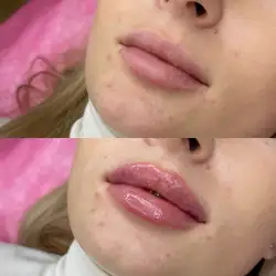 Софія Александрова косметолог