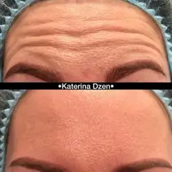 Катерина Дзень