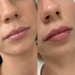 Катерина Труш