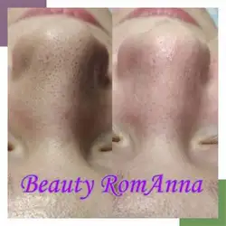 Beauty RomAnna