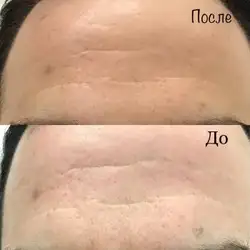 Олена Козак косметолог