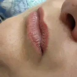 Permanent dream