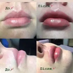 Наталія Сорохтей Косметолог