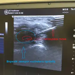 Achilles травматологія та ортопедія