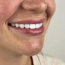 Pretty Smile — Одеса
