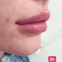 Лещенко Сергій