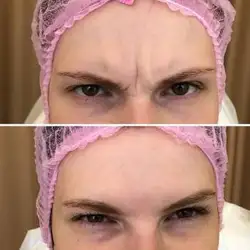 Альона Туманцова