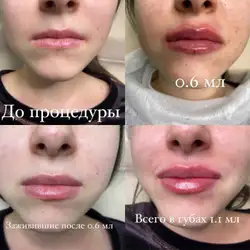 Лариса Жукова