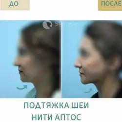 Марина Старцева Косметолог