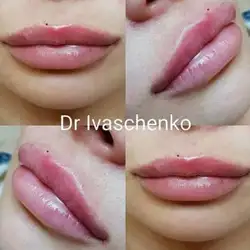 Аліна Іващенко