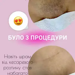 Юлія Войтенко — Дніпро