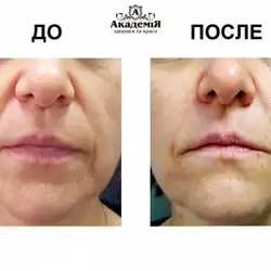 Академія здоров'я та краси