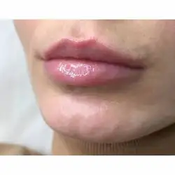 Анна Риндіна — Харьков