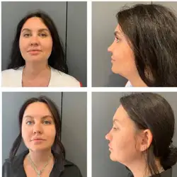Алла Тимченко