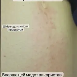 Гуріна Наталя майстер епіляції