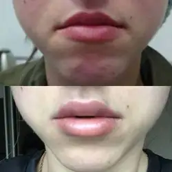 Діана Талавіра — Одесса