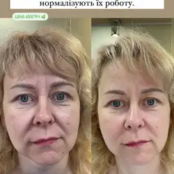 Дарія Бордійчук майстер епіляції