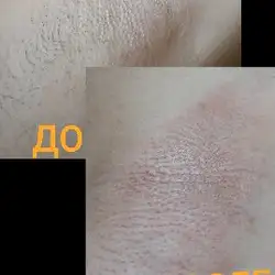 SPA-Шугаринг