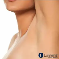 Lumenis