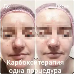Леся Андріанова