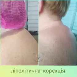 Adelaismassage