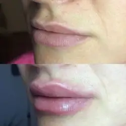 Тетяна Гнатишин Косметолог