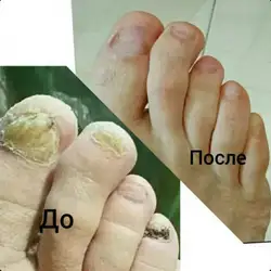 Саміра Кліменко — Харків