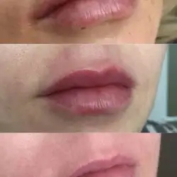 Ілона Потапчук