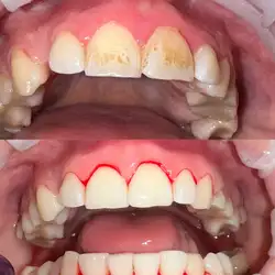 Grin Dental