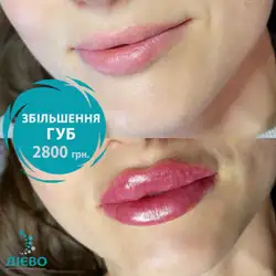 Холодна Аліна