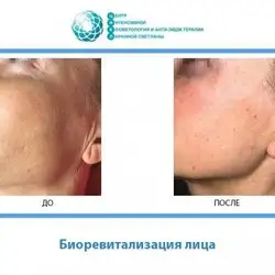 Цикл — Одеса