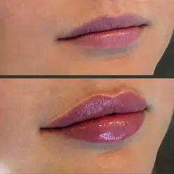 Людмила Бичихіна