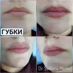 Світлана Медвідь