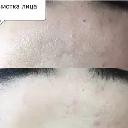 Батерфляй