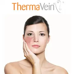 ThermaVein