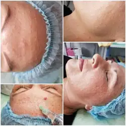 Алевтина — Миколаїв