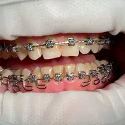 Loa Love Dental