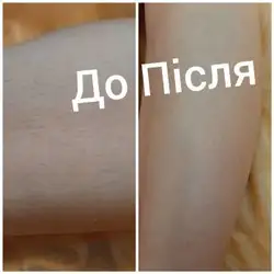 Наталія Вишняк майстер депіляції