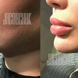 Андрій Якобчук - косметолог