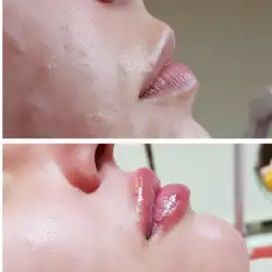 Алла Танасєвська Косметолог