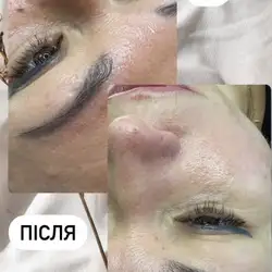 Аліна Ловакова