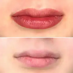 Анна Каттерфельд — Одесса